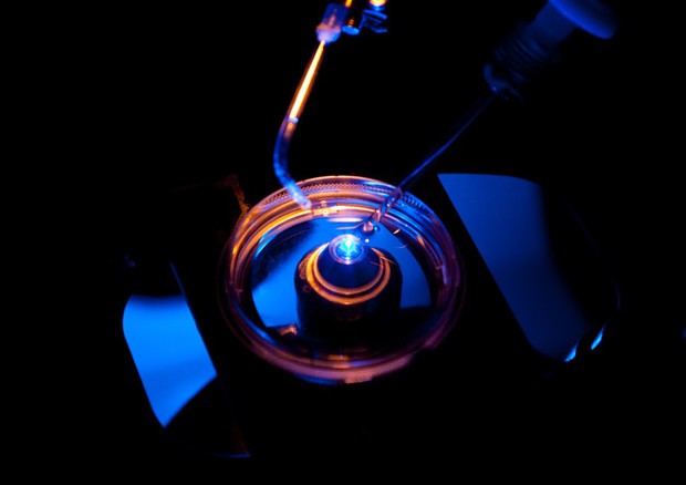 A protein and a ray of blue light against pain that come from the nervous system (source: Milan State University) © Ansa