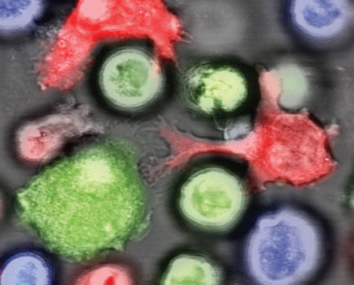 Le Cellule Staminali Dei Tumori Non Sono Piu Invisibili Biotech Ansa It