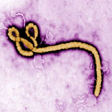 Il virus Ebola