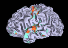 Il cervello e' governato da 12 'hub'