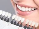 Boom sbiancamento denti, spesi 30 milioni ogni anno (ANSA)