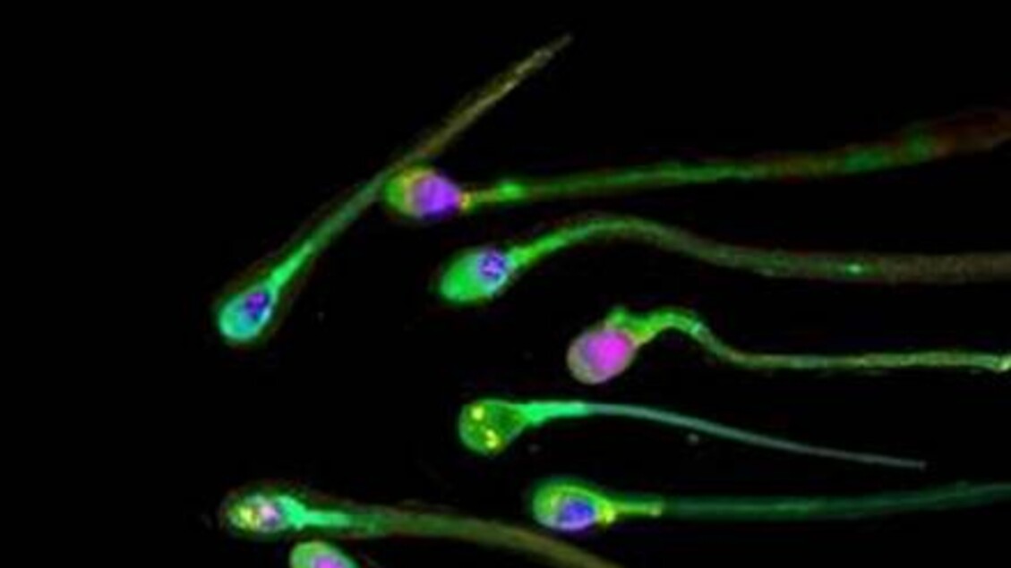 Più longevi gli uomini che hanno una migliore qualità del seme