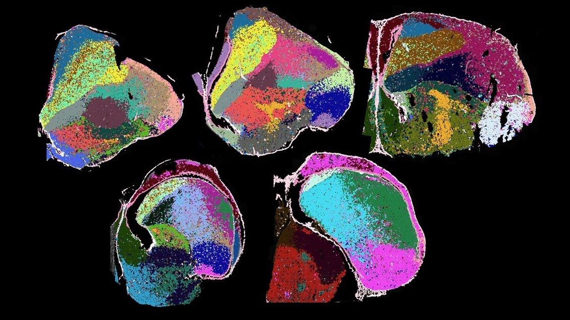 Riscritta la storia dell’evoluzione del cervello