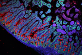 Cellule dell'intestino umano (fonte: Grace Burgin, Noga Rogel &amp; Moshe Biton, Klarman Cell Observatory, Broad Institute)