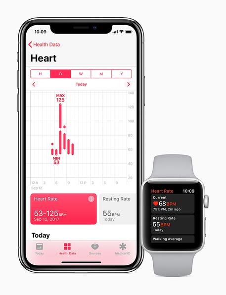 Apple Watch vuole diagnosticare le aritmie © ANSA