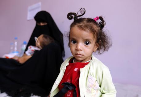 Yemen: Save The Children, 85,000 Kids Died Of Starvation - English ...