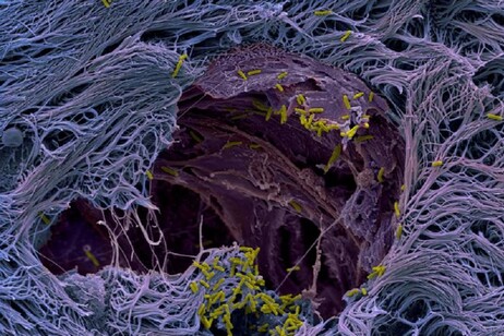 Immagine al microscopio elettronico a scansione di batteri Pseudomonas aeruginosa sul tessuto di polmoni umani (Benoit Laventie, Biozentrum, University of Basel)