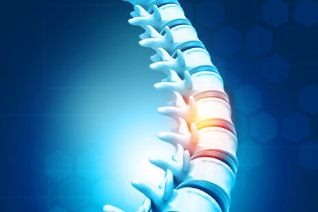 Colonna vertebrale umana e le sue lesioni. fonte: Rasi Bhadramani - iStock