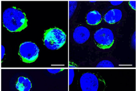 Il budesonide contrasta la capacità delle cellule cancerose di proliferare e migrare (fonte: Journal of Experimental &amp; Clinical Cancer Research, 2024)