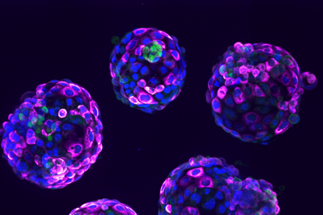 La ricerca sui modelli embrionali da cellule staminali porterà a nuovi importanti trattamenti (fonte: Irene Zorzan and Teresa Rayon, Babraham Institute)