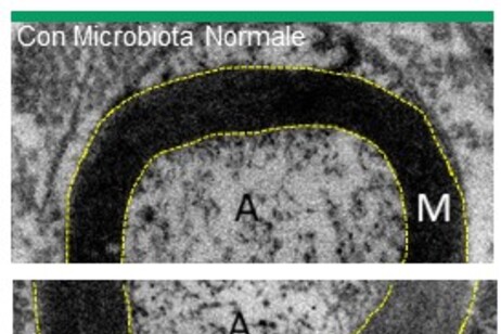 I nervi che si sono sviluppati in assenza di microbiota hanno una guaina mielinica più spessa (fonte: Stefania Raimondo - Giulia Ronchi - Giovanna Gambarotta (NICO-UNITO))