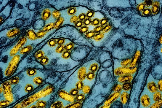 In giallo le particelle del virus dell'influenza aviaria A H5N1 viste al microscopio (fonte: CDC e NIAID, via Flickr)