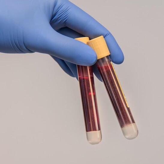 test sangue (fonte: Pixabay)