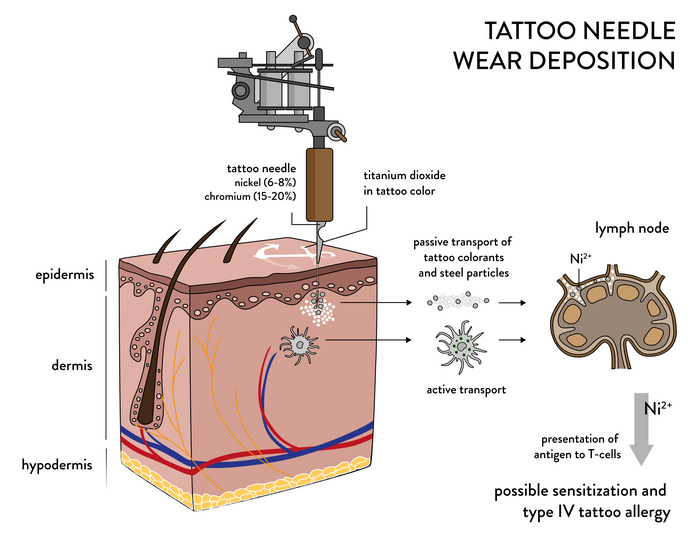 Tatuaggi: dopo l'inchiostro, gli aghi sospettati di provocare allergie -  Napoli Village - Quotidiano di Informazioni Online