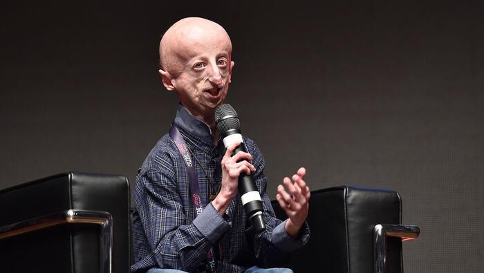 Sammy Basso died, made progeria known – News