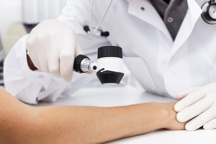 Melanoma, l'immunoterapia 'dual block' diventa standard