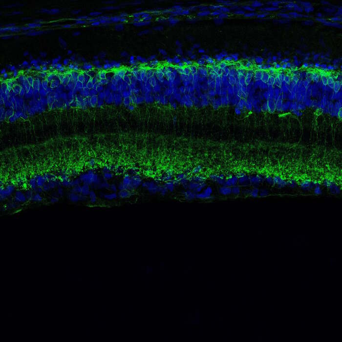 Una molecola italiana risveglia i neuroni della retina