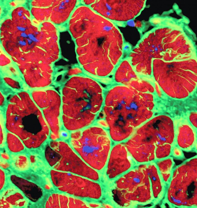 Un cerotto fatto di staminali per riparare le ferite del cuore