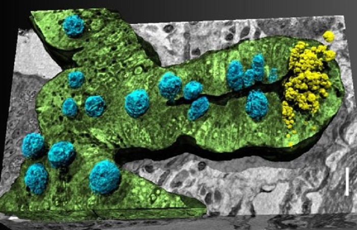 Alzheimer, scoperto ai raggi X il legame tra intestino e cervello