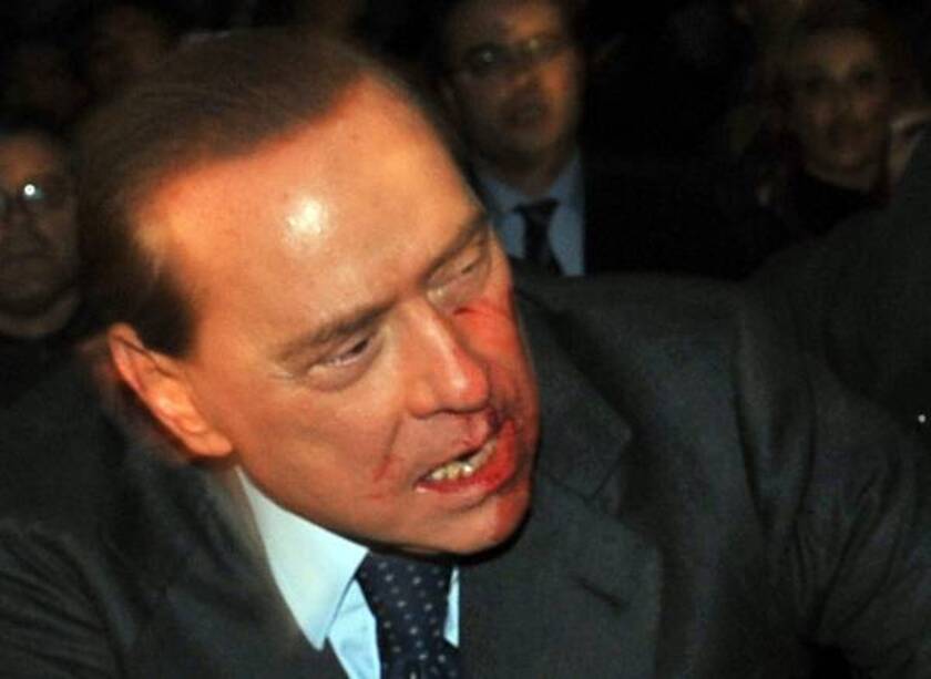Berlusconi ferito da un oggetto a Milano nel 2009