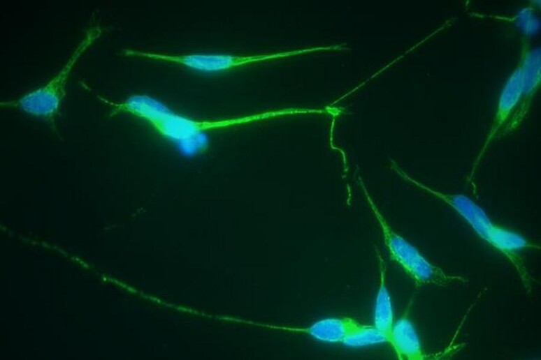 Messo a punto un sistema ibrido, fatto di neuroni e chip (fonte: Caponi, et al.) - RIPRODUZIONE RISERVATA