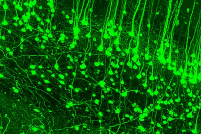 La prima immagine del sistema nervoso vista  'in diretta ', nel corpo di un topo reso trasparente (fonte: C. Pna et al., Nature Methods, LMU) - RIPRODUZIONE RISERVATA