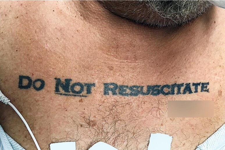 Uomo con tatuaggio  'Non rianimare ' - RIPRODUZIONE RISERVATA