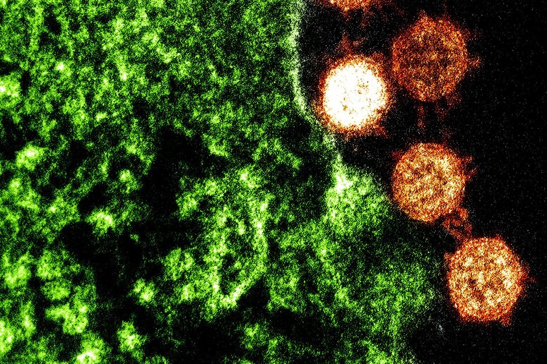 Particelle del virus della Sars (fonte: NIAID) - RIPRODUZIONE RISERVATA