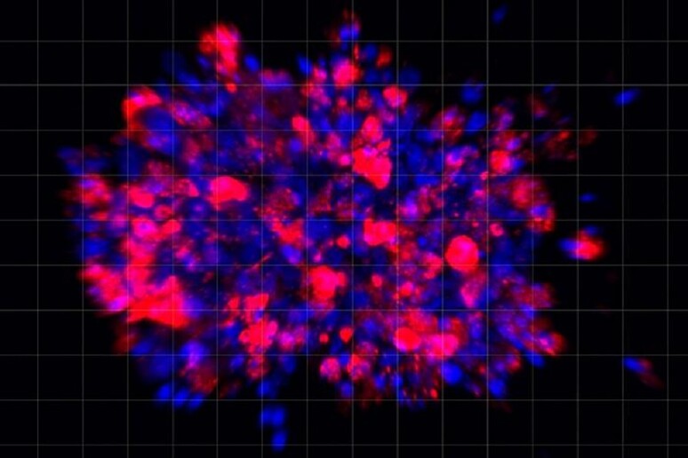 Un farmaco induce la morte delle cellule tumorali nell’organoide del pancreas (fonte: Xiaohua Duan) -     RIPRODUZIONE RISERVATA