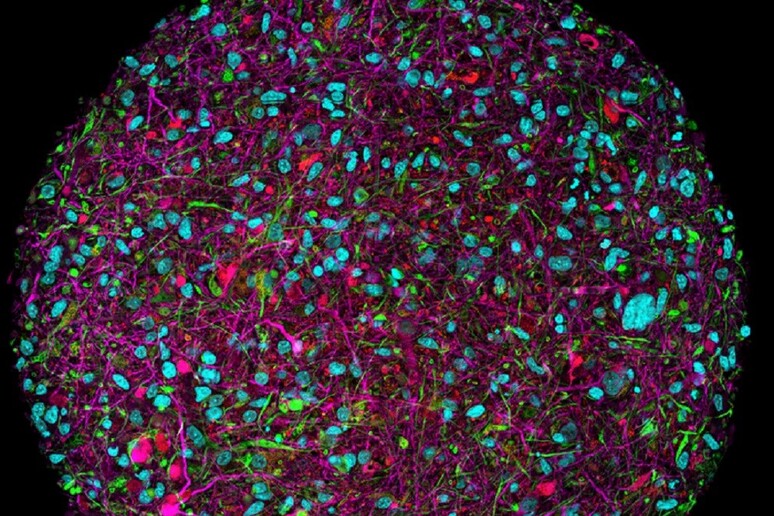 Organoide di cervello umano (fonte: Thomas Hartung, Johns Hopkins University) - RIPRODUZIONE RISERVATA