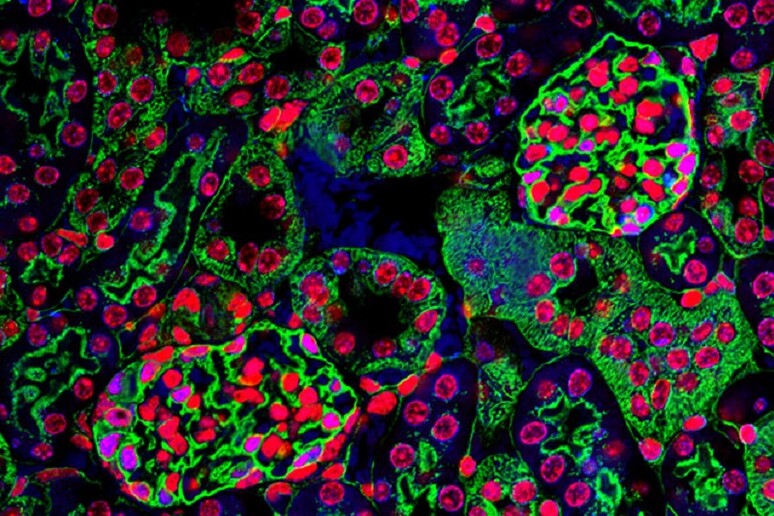 In verde le strutture del rene chiamate glomeruli, che hanno la funzione di filtrare urina e sangue (fonte: Derek Sung, National Heart, Lung, &amp; Blood Institute) - RIPRODUZIONE RISERVATA