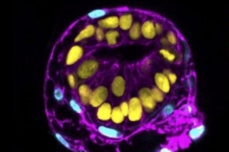 L 'embrioide che imita lo sviluppo nell 'utero. In azzurro le strutture esterne all 'embrione (fonte: Yale School of Medicine) - RIPRODUZIONE RISERVATA