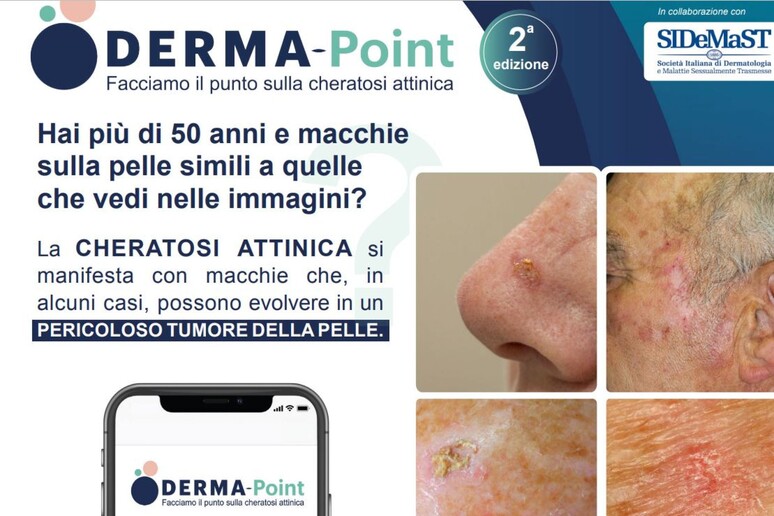 Salute: al via la campagna Derma Point sulla cheratosi attinica - Notizie -  Ansa.it