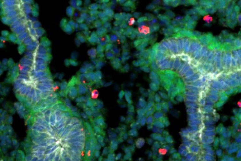 Particolare dei polmoni chimera ottenuti utilizzando cellule di ratto (fonte:  Shunsuke Yuri) -     RIPRODUZIONE RISERVATA