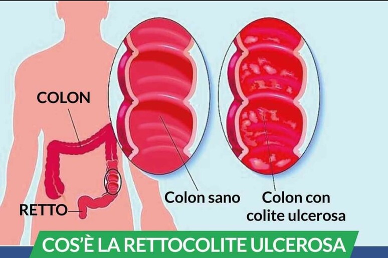 - RIPRODUZIONE RISERVATA