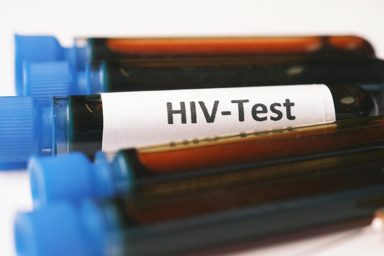 Testing Week, Iss aggiorna mappa per test Hiv,epatiti e sifilide - RIPRODUZIONE RISERVATA