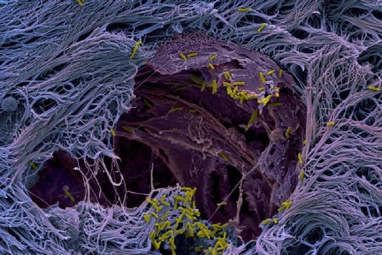 Immagine al microscopio elettronico a scansione di batteri Pseudomonas aeruginosa sul tessuto di polmoni umani (Benoit Laventie, Biozentrum, University of Basel) - RIPRODUZIONE RISERVATA
