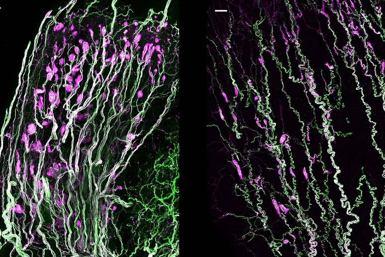 le cellule nervose sensoriali chiamate corpuscoli di Krause sono più dense sul clitoride dei topi femmine (a sinistra) che sul pene dei topi maschi (a destra). Crediti: Lijun Qi, Michael Iskols e David Ginty - RIPRODUZIONE RISERVATA