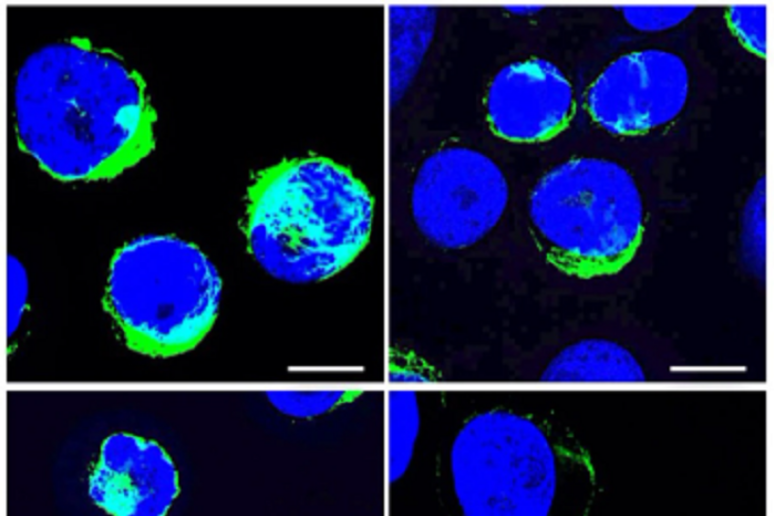 Il budesonide contrasta la capacità delle cellule cancerose di proliferare e migrare (fonte: Journal of Experimental &amp; Clinical Cancer Research, 2024) - RIPRODUZIONE RISERVATA